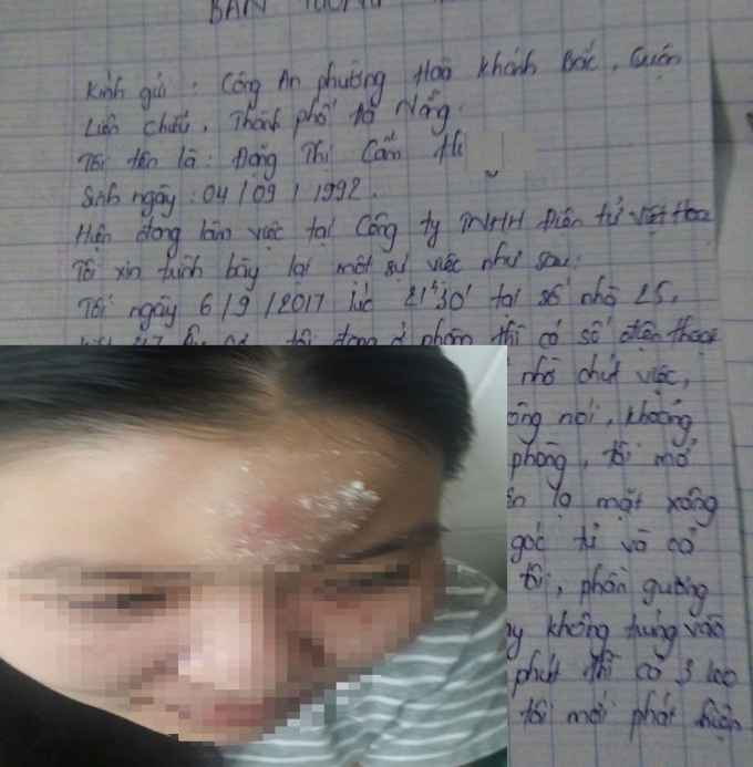 Chị H. (ảnh nhỏ) bị thương ở v&ugrave;ng mặt sau khi bị 3 kẻ lạ mặt h&agrave;nh hung ngay trong ph&ograve;ng trọ.