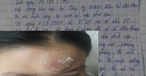 Đà Nẵng: Nghi vấn kẻ gian hành hung nữ công nhân trong phòng trọ để dằn mặt