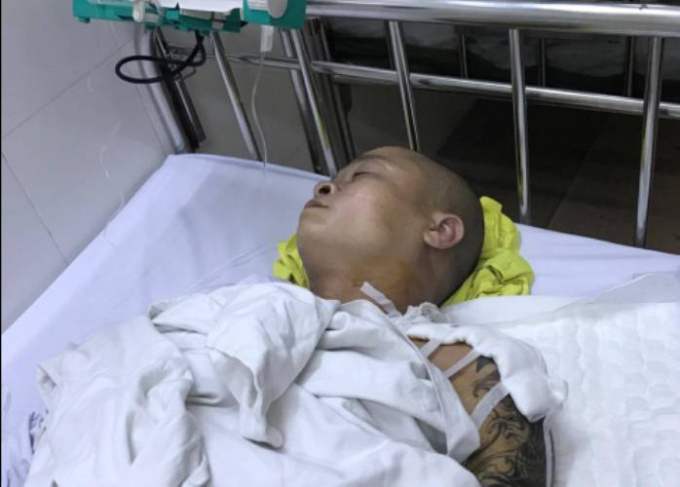 Anh Trương Vĩnh Thắng đang được điều trị t&iacute;ch cực sau ca mổ tại BV 103.