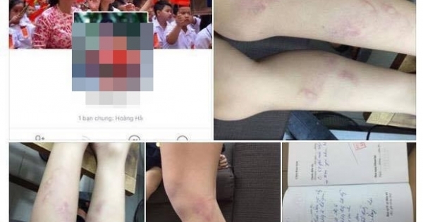 Chủ tịch Hà Nội yêu cầu xử lý vụ 11 học sinh lớp hai bị giáo viên bạo hành