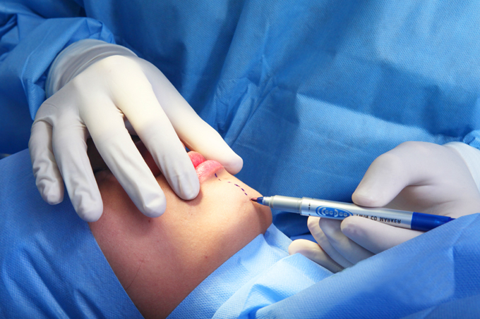 Ảnh minh họa.&nbsp;