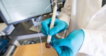 Bút thông minh phát hiện ung thư trong 10 giây