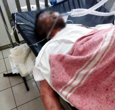 Anh Trần Văn Th. khi đang điều trị tại bệnh viện T.Ư Huế.