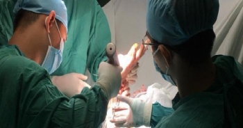 Trắng đêm phẫu thuật nối bàn tay đã đứt lìa cho thanh niên bị chém khi đưa người đi cấp cứu
