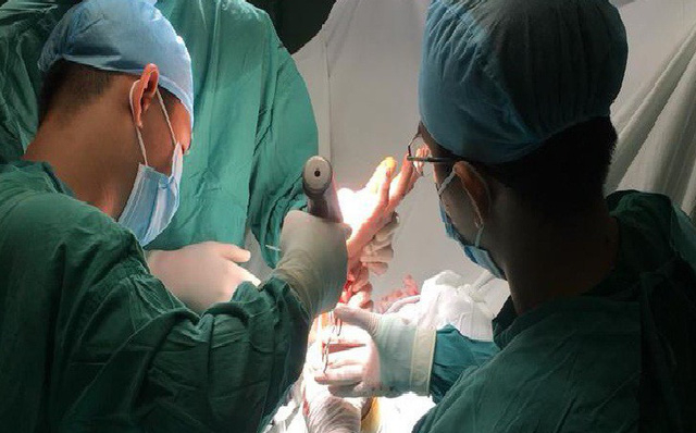 Ca mổ k&eacute;o d&agrave;i hơn 5 tiếng. (ảnh bệnh viện cung cấp)