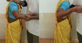 Hội chứng “xương biến mất” thách thức y học hiện đại