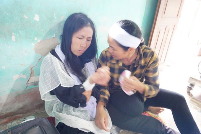 Chị Nguyệt tr&ecirc;n tay c&ograve;n thương t&iacute;ch đau đớn sau c&aacute;i chết của chồng v&agrave; con trai.