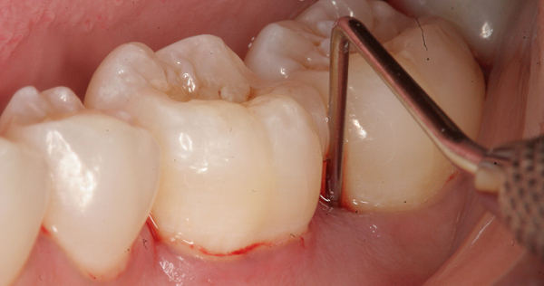 Ngộ độc thuốc t&ecirc; l&agrave; biến chứng cực kỳ nguy hiểm. Ảnh: minh họa