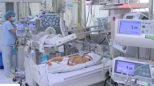 Virus hợp b&agrave;o h&ocirc; hấp (RSV) l&agrave; virus thường gặp, kh&ocirc;ng phải virus mới hay lạ. Ảnh: minh họa/Vietnamnet.