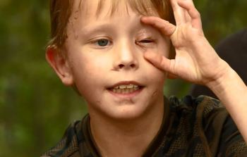 Cậu bé 8 tuổi sống xót thần kỳ sau cuộc chiến tay đôi với sư tử