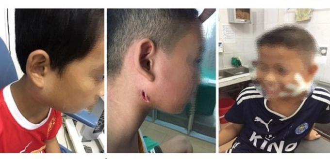 benhwhitmoreanmoncothecolaytunguoisangnguoi_rfhq