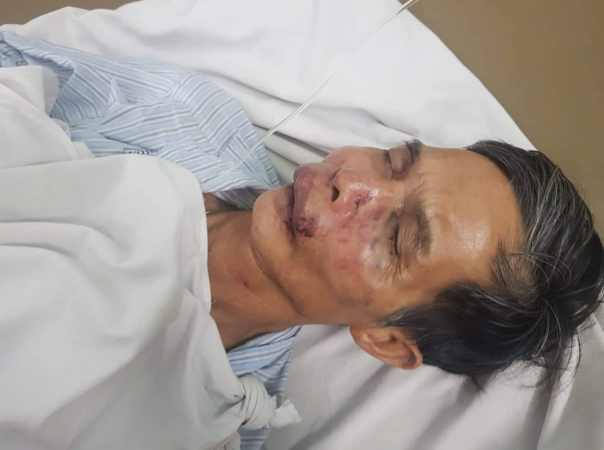 received_413172586005170.