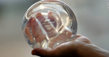 Hơn 400.000 phụ nữ lao đao vì trót làm đẹp bằng túi ngực silicon “tự chế”