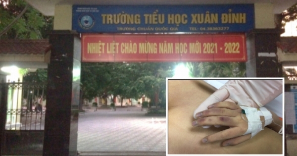 Khởi tố người bố bạo hành cháu bé 6 tuổi dẫn đến tử vong