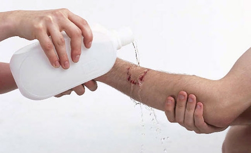 Khi bị ch&oacute;, m&egrave;o cắn&nbsp;cần rửa ngay thật kỹ vết thương bằng x&agrave; ph&ograve;ng dưới v&ograve;i nước mạnh &iacute;t nhất l&agrave; 5 ph&uacute;t. Ảnh: minh họa