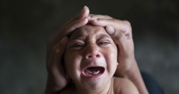 Thái Lan ghi nhận hai trường hợp mắc chứng đầu nhỏ đầu tiên liên quan đến virus Zika