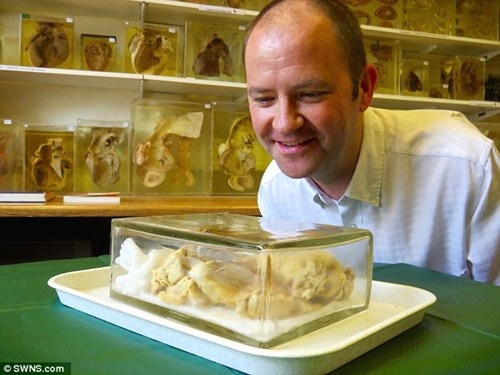 Anh Kieran b&ecirc;n cạnh quả tim đ&atilde; hiến tặng cho y học của ch&iacute;nh m&igrave;nh.