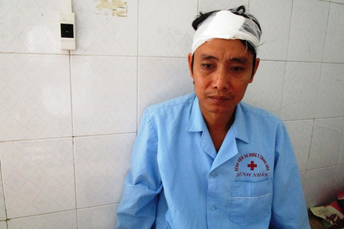 Anh Thiều Văn H&ugrave;ng nạn nh&acirc;n bị 2 thanh ni&ecirc;n lạ mặt đ&aacute;nh.