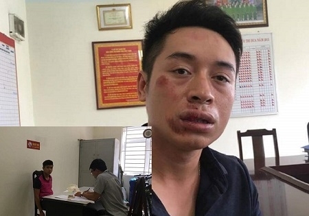 Hà Nội: Bắt đối tượng ngông cuồng đấm gãy răng 1 CSGT