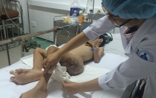 Cậu bé 6 tuổi mang nhiều bướu máu dũng cảm đối mặt cái chết