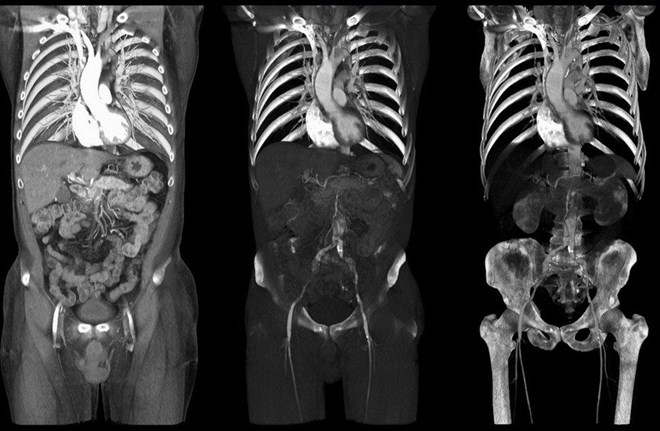 Nguồn: Getty Images