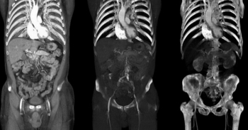 Bác sỹ phẫu thuật cắt nhầm thận do... bệnh nhân trùng tên