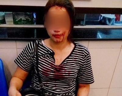 Làm rõ thông tin Sĩ quan công an hành hung bạn gái vì bị từ chối tình cảm