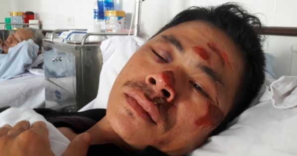 Chở khách đến quán karaoke, tài xế bị đánh nhập viện