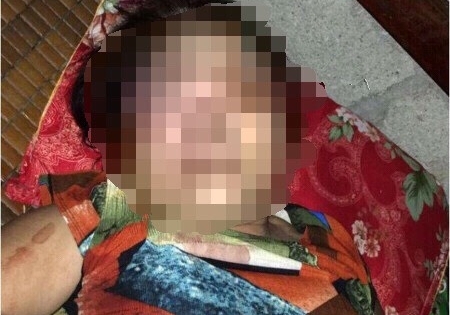 Huế: Mâu thuẫn trên chiếu bạc, ra tay đánh mù mắt nạn nhân