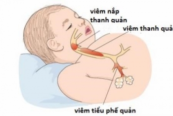 Thời tiết chuyển lạnh, nhiều dịch bệnh có nguy cơ bùng phát