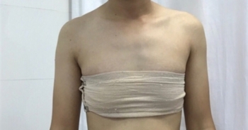 Bộ Y tế đề xuất người độc thân 18 tuổi trở lên mới được phép chuyển giới