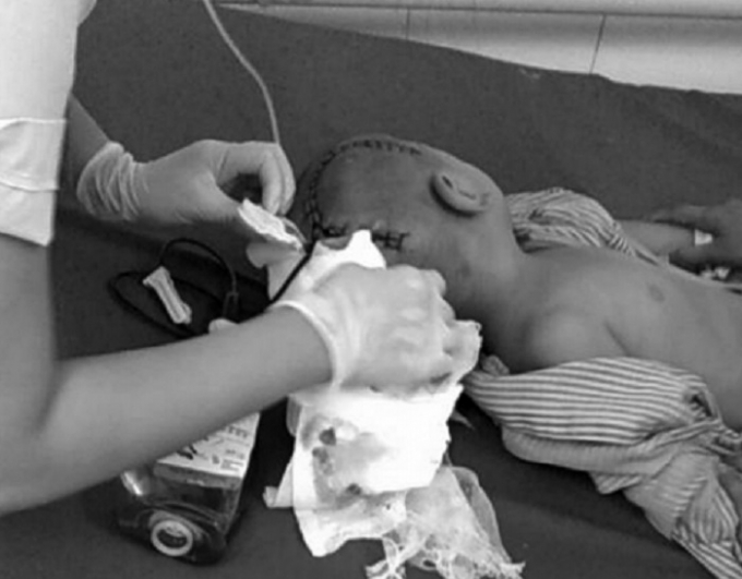 Ch&aacute;u Huy phải mổ gấp để giữ t&iacute;nh mạng (Ảnh: GĐCC)