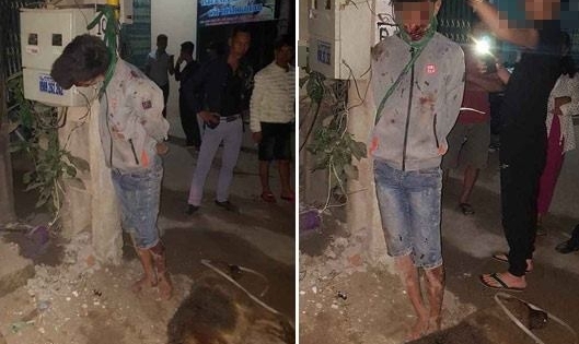 Nam thanh niên bị trói, treo lên cột điện vì trộm chó