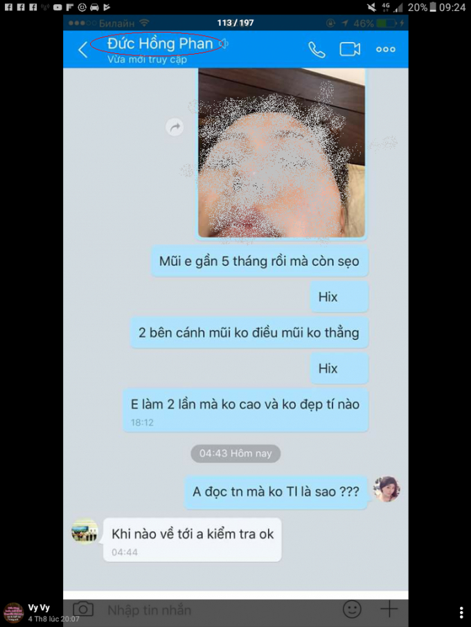 Chị Ng. cung cấp đoạn trao đổi với nội dung li&ecirc;n quan đến phẫu thuật mũi của chị với người được cho l&agrave; &ocirc;ng Hồng.