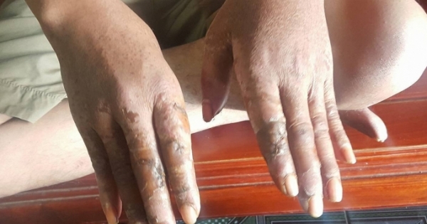 Nghệ An: Điều tra nhóm đối tượng hung hãn chém lái xe và phụ xe khách trọng thương