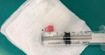 Nghệ An: Nuốt mẩu bút chì, bé gái suýt "mất mạng"