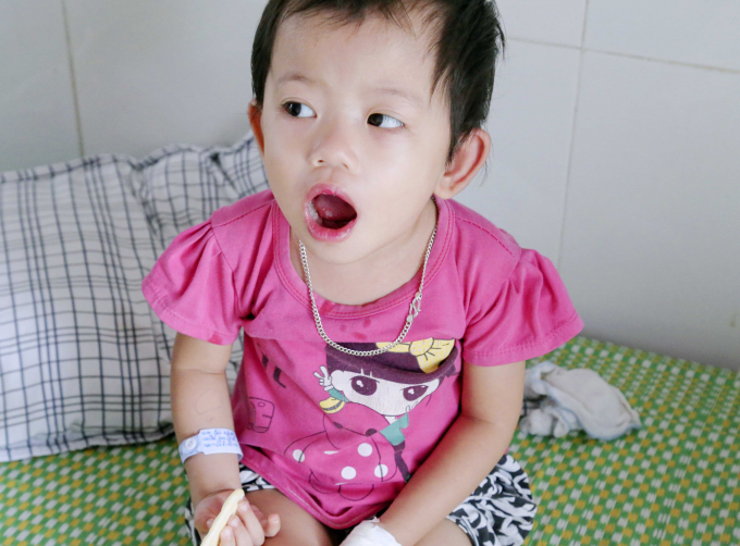 Bệnh nhi bị tay ch&acirc;n miệng đang được điều trị tại BV Đa khoa Ph&uacute; Thọ