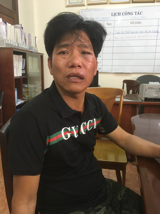 Nguyễn Th&ugrave;y Viễn sau khi bị bắt