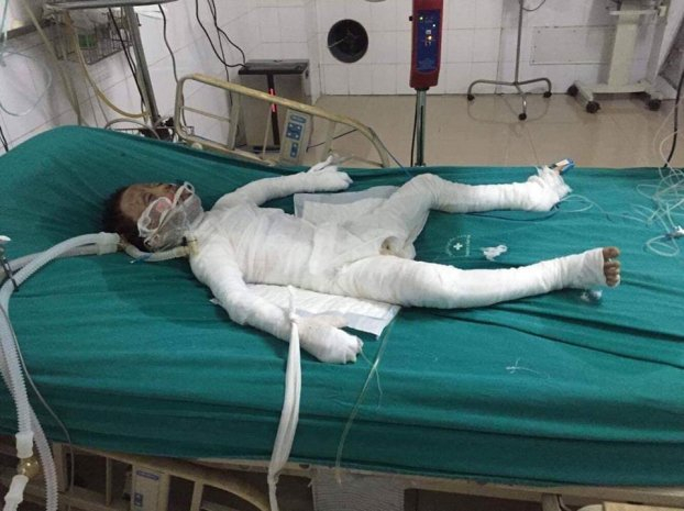 Vụ ch&aacute;y khiến 3 người trong một gia đ&igrave;nh bị thương, trong đ&oacute; c&oacute; một b&eacute; trai 6 tuổi.&nbsp;(Ảnh: b&aacute;o Gia đ&igrave;nh mới)