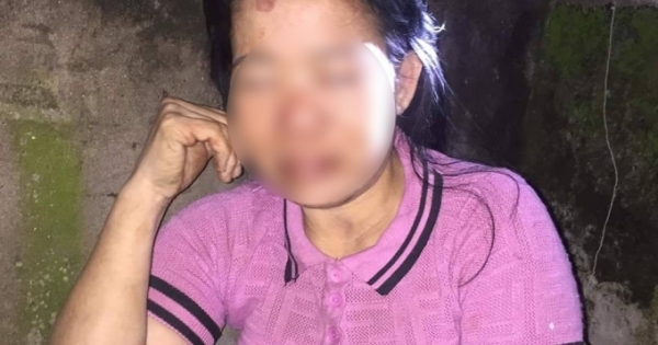 Người phụ nữ bên vệ đường với thương tích nặng nghi bị kẻ lạ đánh đập