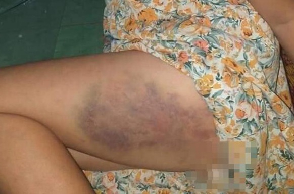 20201013_160844-1612