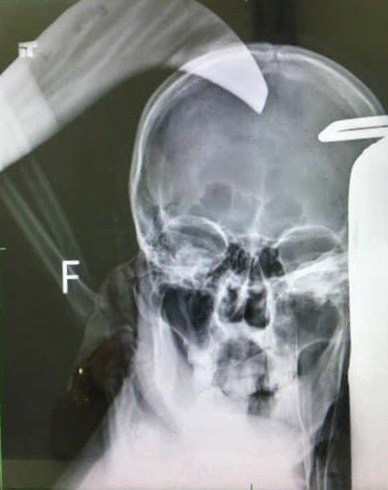 z2865758060002_6346b18706f9bb3b2d93a202cfb6fbfd (1)