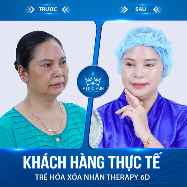 Khách hàng hài lòng với kết quả bất ngờ tại VTM Quốc Tế  Medic Skin.