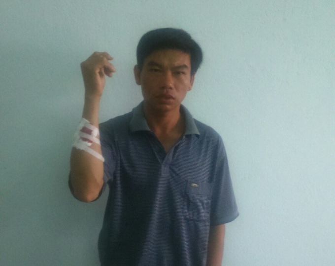 Ch&acirc;u Ngọc L&yacute; với vết thương do cuộc x&ocirc; x&aacute;t g&acirc;y ra