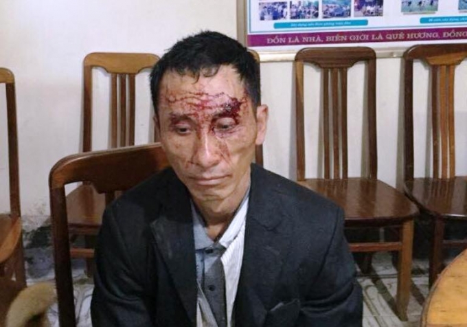 Đối tượng V&agrave; X&aacute;i Xử tại cơ quan điều tra (Ảnh: L.T).