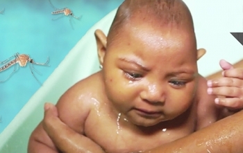 Sắp thử nghiệm thuốc điều trị Zika trên người