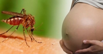 Thắc mắc phổ biến khi virus Zika lan rộng ở Sài Gòn