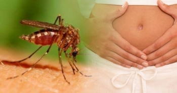 2 bà bầu ở Sài Gòn nhiễm virus Zika phải ngưng thai kỳ