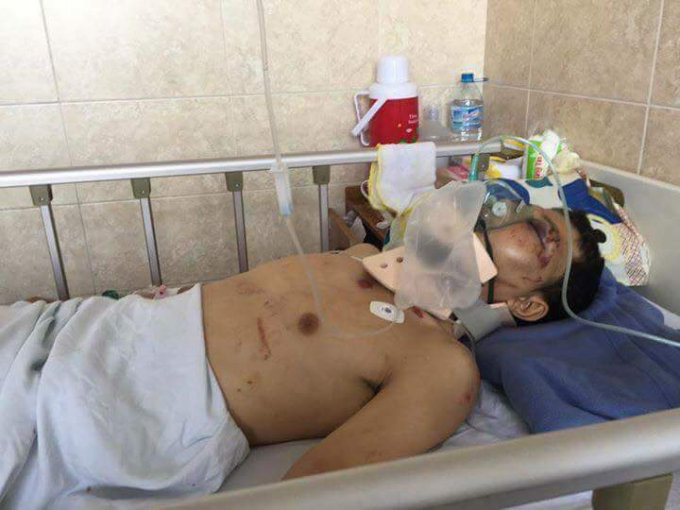 Ho&agrave;n cảnh khốn c&ugrave;ng