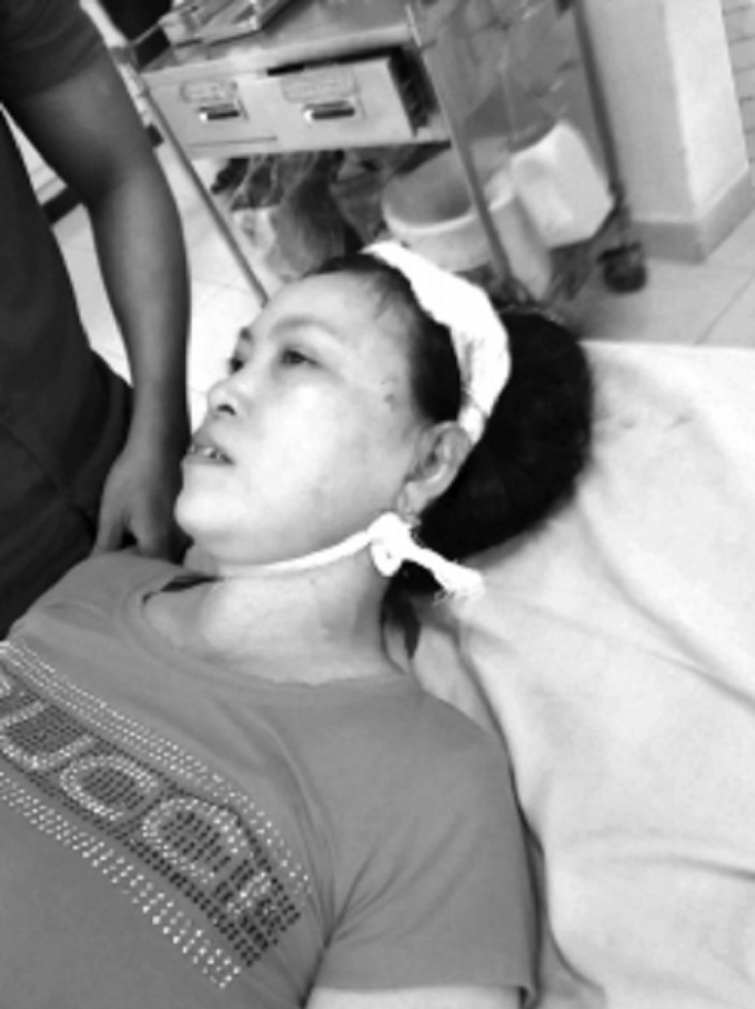 B&agrave; Tượng tại bệnh viện v&agrave; vết thương do con rể g&acirc;y ra.